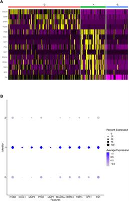 Fibronectin-1 is a dominant mechanism for rheumatoid arthritis via the mediation of synovial fibroblasts activity